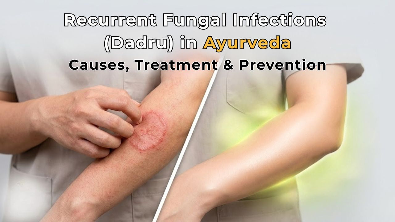 Recurrent Fungal Infections (Dadru) in Ayurveda: Causes, Treatment & Prevention